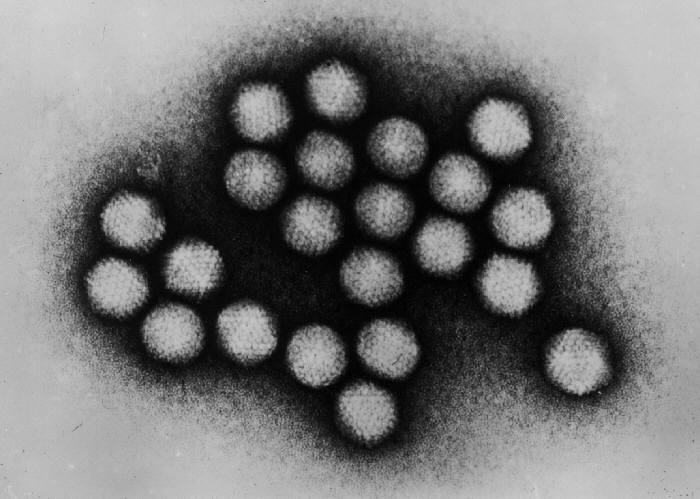 富士フイルムがエボラウイルスに効く薬を開発していた？